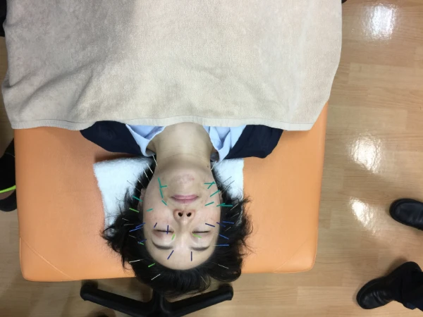 日本鍼灸師会プレセミナー